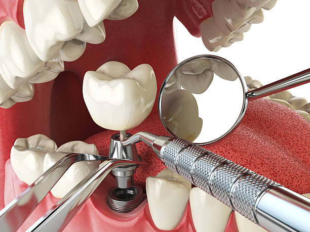 Best Broken or Cracked Tooth Emergency Dentist in Seven Corners, VA