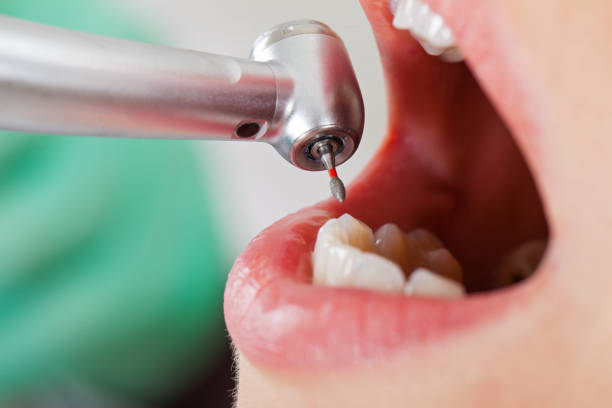 Best Mobile Emergency Dentist in Seven Corners, VA